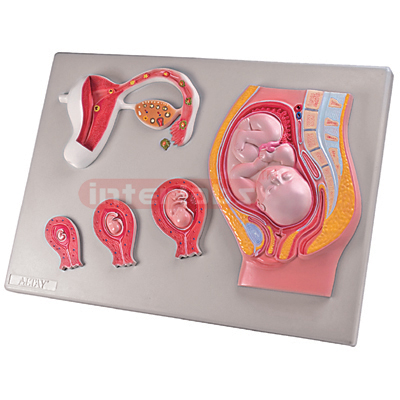 Interlabs? Fetus Development Relief Model